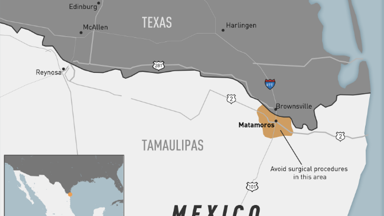 CDC emite advertencia de viaje a ciudad fronteriza mexicana tras infecciones fúngicas en residentes de Texas